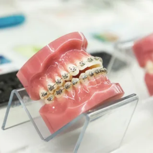 آبکاری استیل در تولید تجهیزات آب و فاضلاب